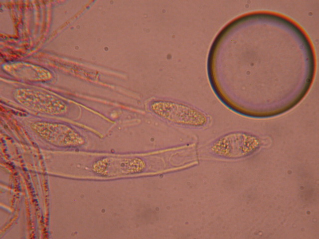 Sarcoscypha jurana... al microscopio